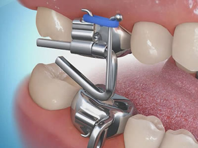 orthopedic treatment